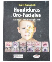 Orofacial Cleft Deformities Our Story Books Queen Catalina