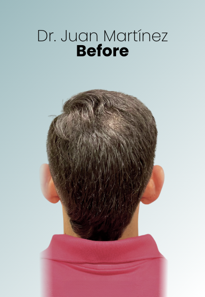 Ear Surgery Procedure Img1 Queen Catalina