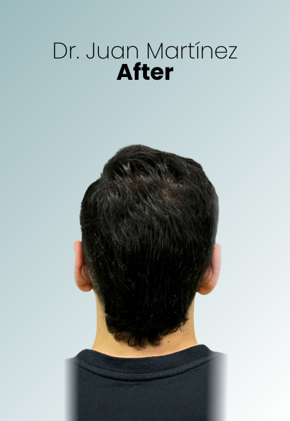 Ear Surgery Procedure Img2 Queen Catalina