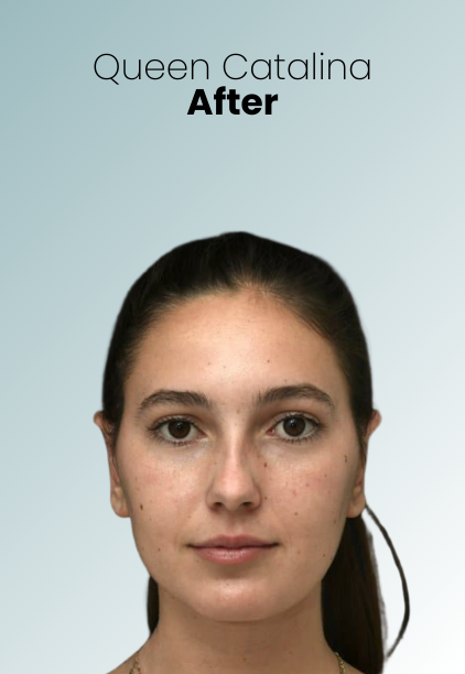 Ear Surgery Procedure Img5 Queen Catalina