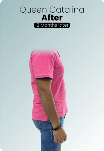 Gastric Balloon Procedure Img1 Queen Catalina