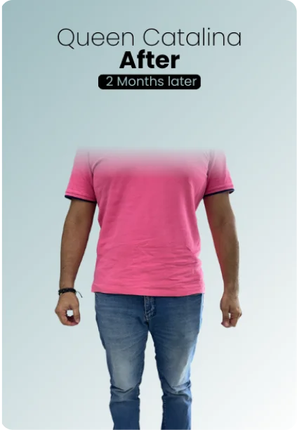 Gastric Balloon Procedure Img3 Queen Catalina