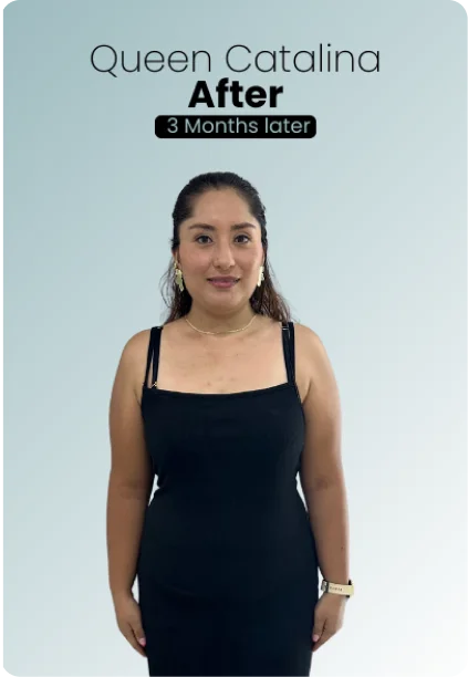 Gastric Sleeve Procedure Img1 Queen Catalina