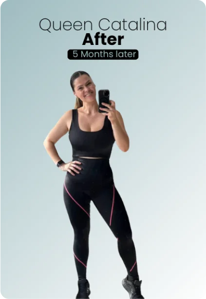 Gastric Sleeve Procedure Img2 Queen Catalina