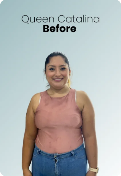 Gastric Sleeve Procedure Img3 Queen Catalina