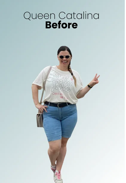 Gastric Sleeve Procedure Img4 Queen Catalina