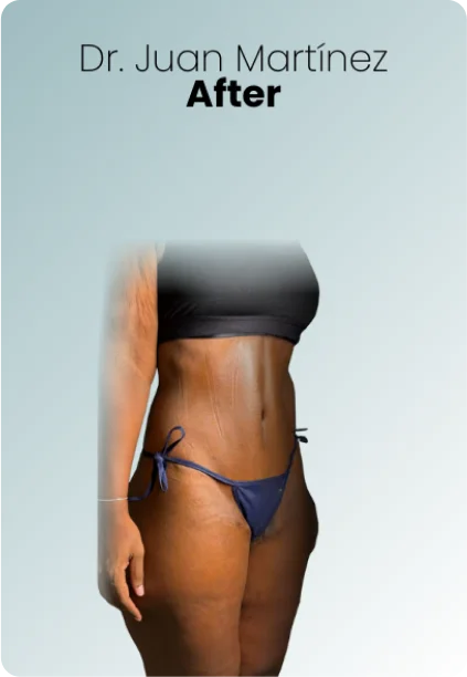 Post Bariatric Surgery Procedure Img4 Queen Catalina