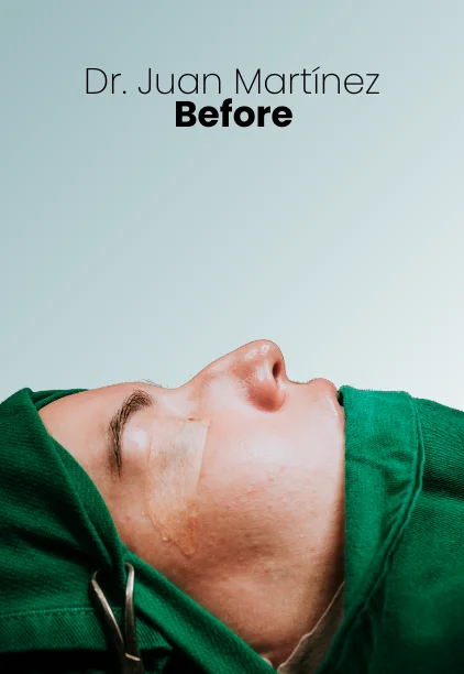 Rhinoplasty Procedure Img3 Queen Catalina