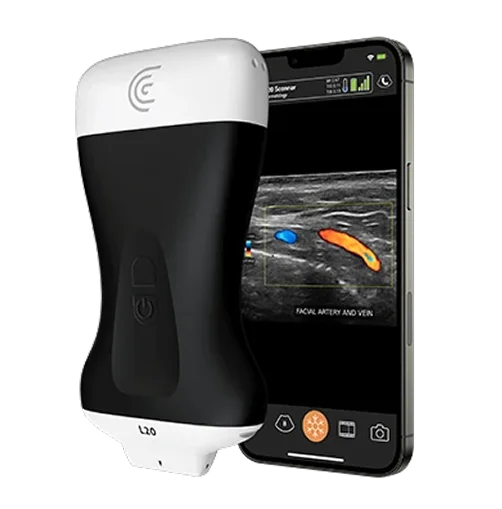 Ultrasound Guided Fat Transfer Modal Packages Queen Catalina