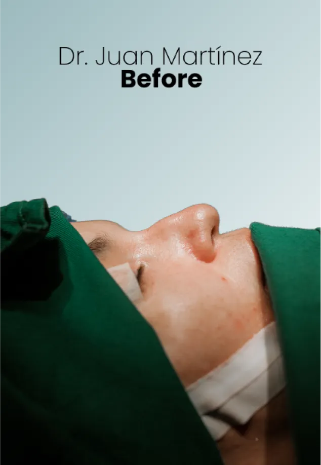 Rhinoplasty Procedure Img9 Queen Catalina