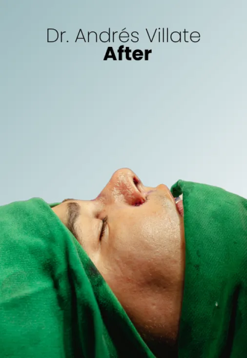 Surgeon Biography Andres Villate Procedure Img1 Queen Catalina