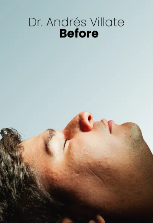 Surgeon Biography Andres Villate Procedure Img2 Queen Catalina