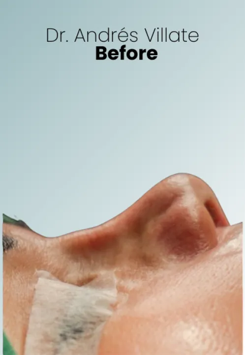 Surgeon Biography Andres Villate Procedure Img4 Queen Catalina