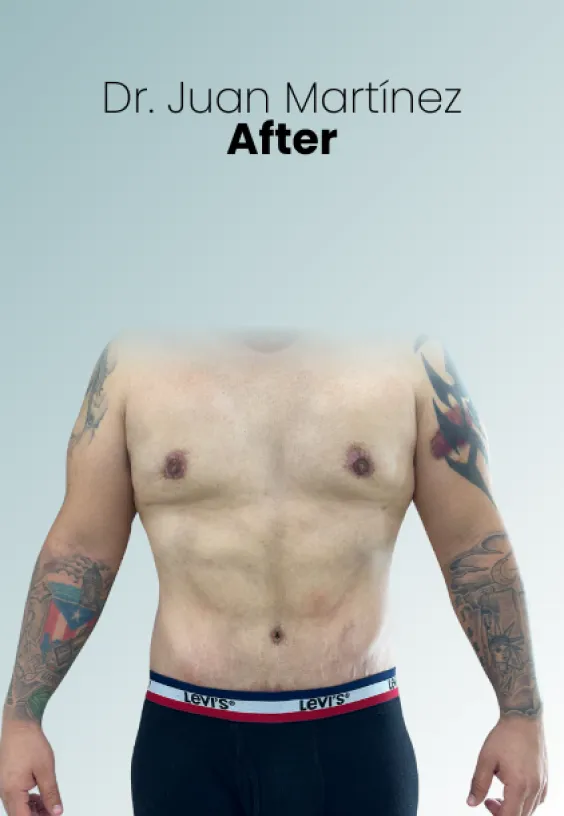 Surgeon Biography Juan Martinez Procedure Img100 Queen Catalina