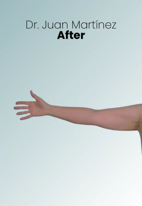 Surgeon Biography Juan Martinez Procedure Img102 Queen Catalina