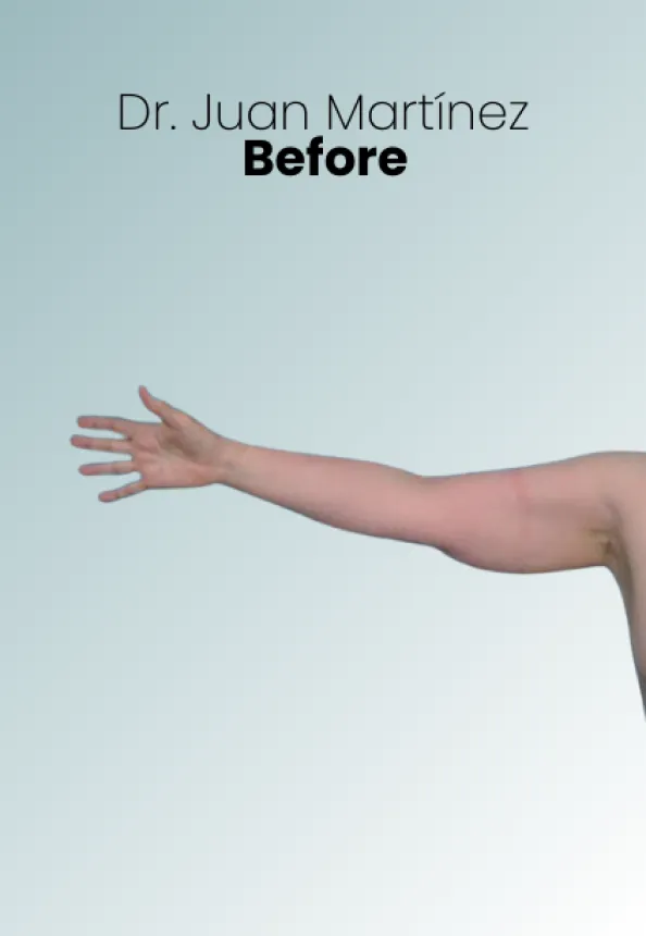 Surgeon Biography Juan Martinez Procedure Img103 Queen Catalina