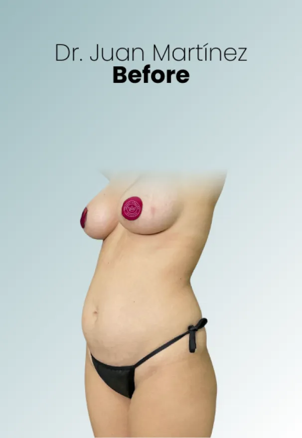 Surgeon Biography Juan Martinez Procedure Img109 Queen Catalina