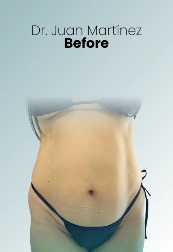 Surgeon Biography Juan Martinez Procedure Img112 Queen Catalina