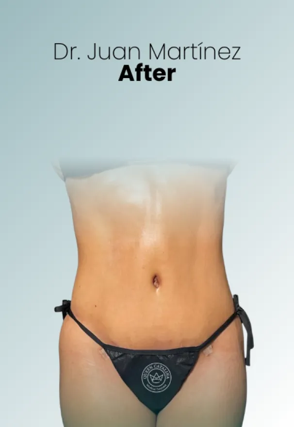 Surgeon Biography Juan Martinez Procedure Img113 Queen Catalina