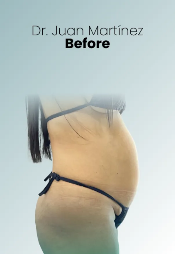 Surgeon Biography Juan Martinez Procedure Img115 Queen Catalina