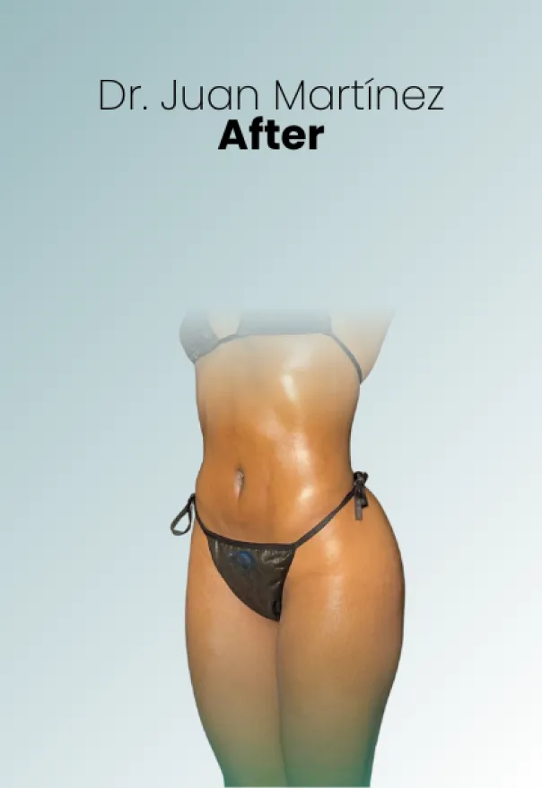 Surgeon Biography Juan Martinez Procedure Img116 Queen Catalina