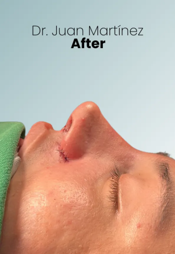 Surgeon Biography Juan Martinez Procedure Img15 Queen Catalina