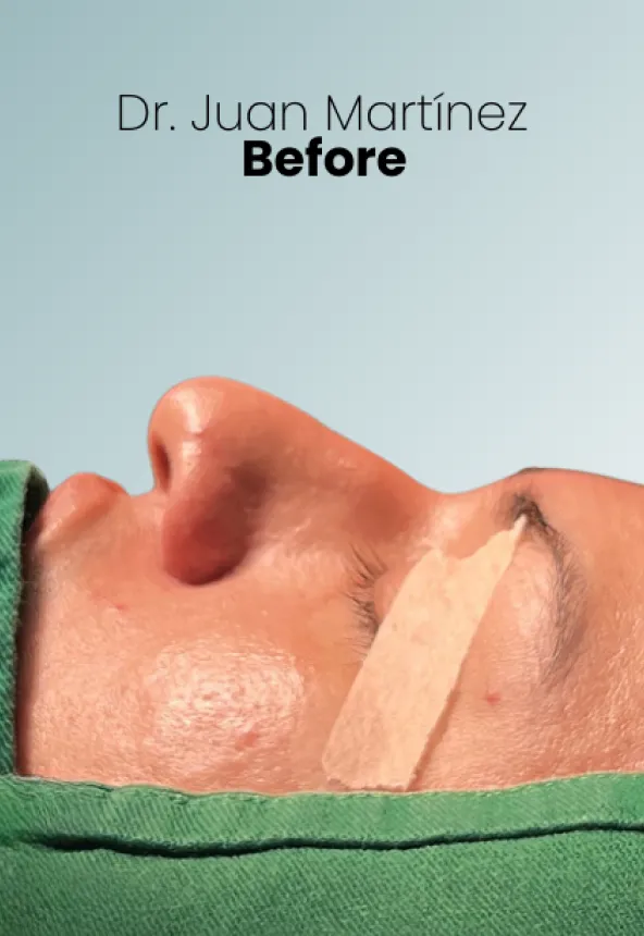 Surgeon Biography Juan Martinez Procedure Img16 Queen Catalina