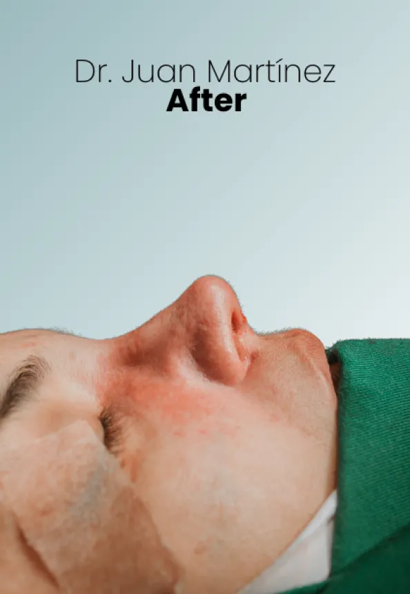 Surgeon Biography Juan Martinez Procedure Img17 Queen Catalina