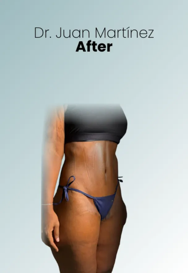 Surgeon Biography Juan Martinez Procedure Img21 Queen Catalina