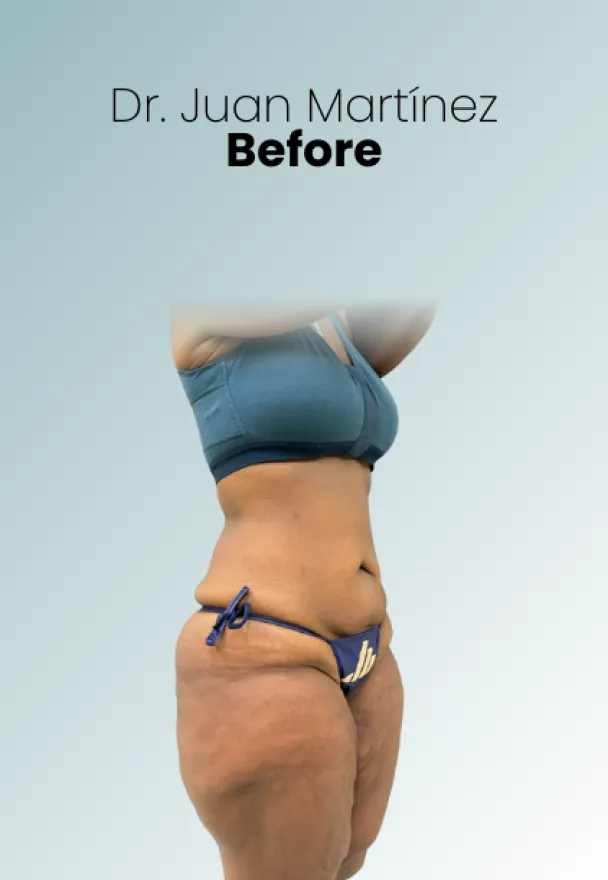 Surgeon Biography Juan Martinez Procedure Img22 Queen Catalina