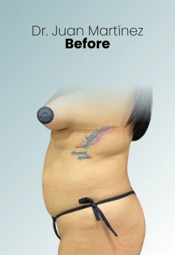 Surgeon Biography Juan Martinez Procedure Img28 Queen Catalina