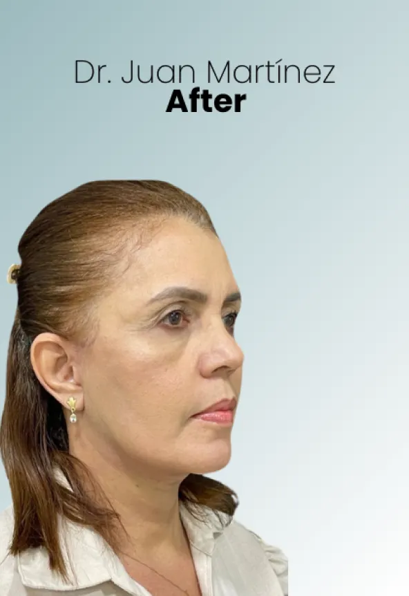 Surgeon Biography Juan Martinez Procedure Img3 Queen Catalina