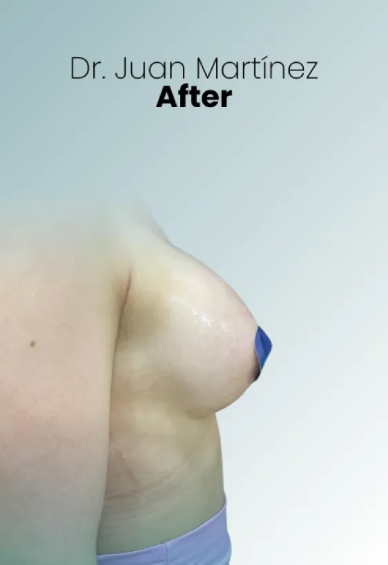 Surgeon Biography Juan Martinez Procedure Img35 Queen Catalina