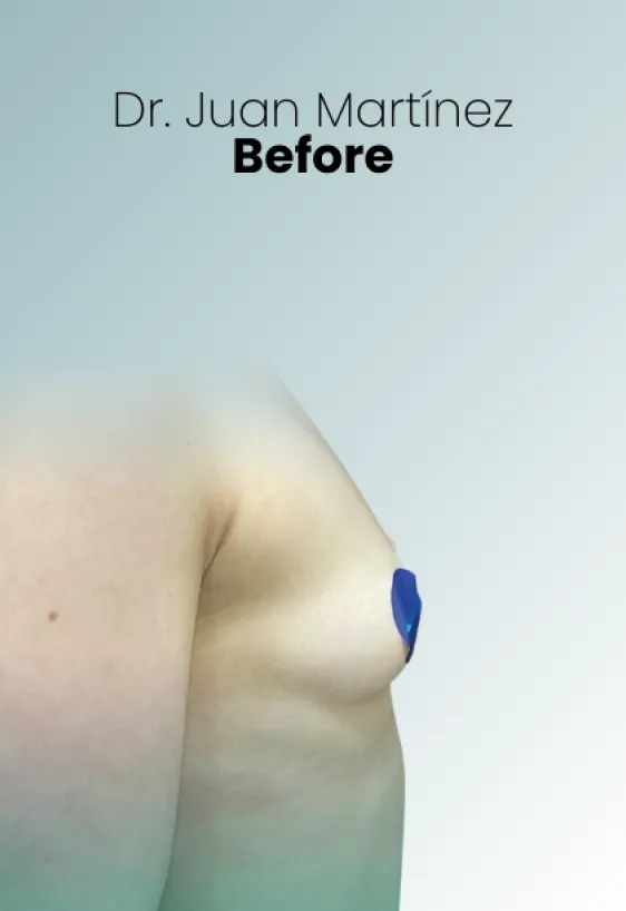 Surgeon Biography Juan Martinez Procedure Img36 Queen Catalina