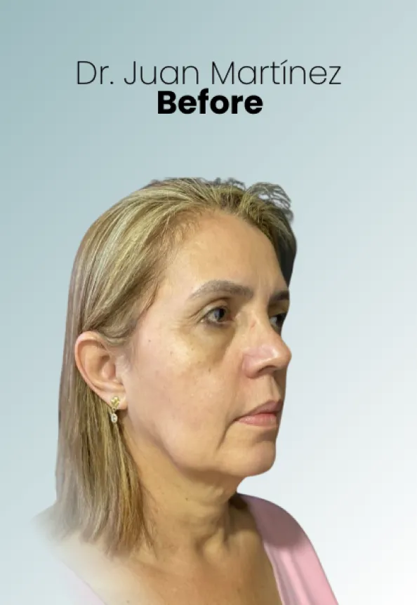 Surgeon Biography Juan Martinez Procedure Img4 Queen Catalina