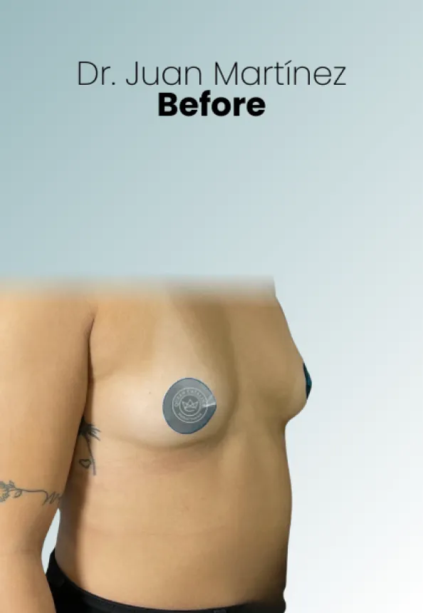 Surgeon Biography Juan Martinez Procedure Img40 Queen Catalina