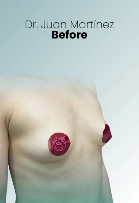 Surgeon Biography Juan Martinez Procedure Img42 Queen Catalina