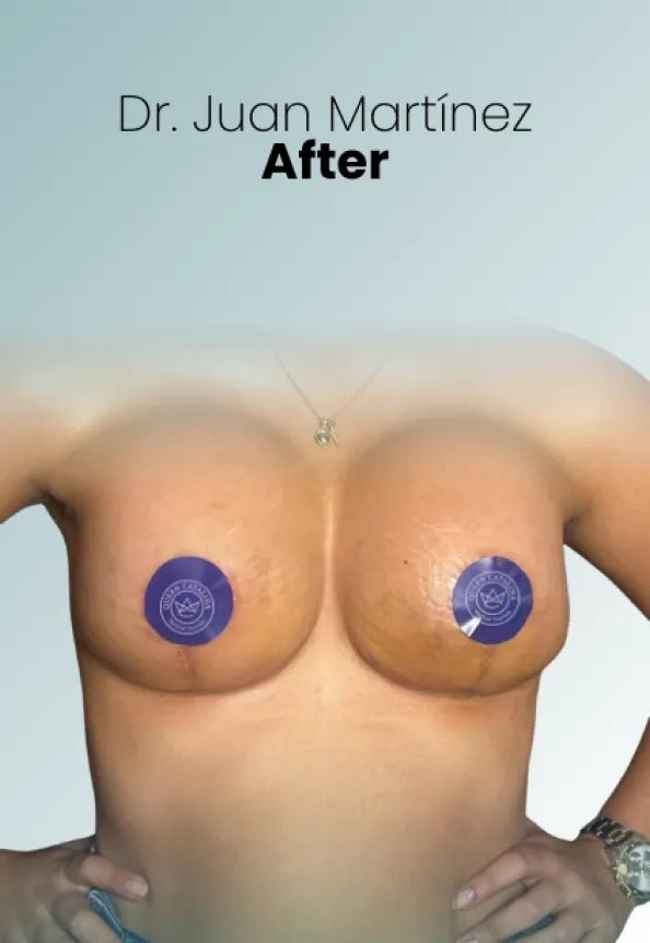 Surgeon Biography Juan Martinez Procedure Img43 Queen Catalina