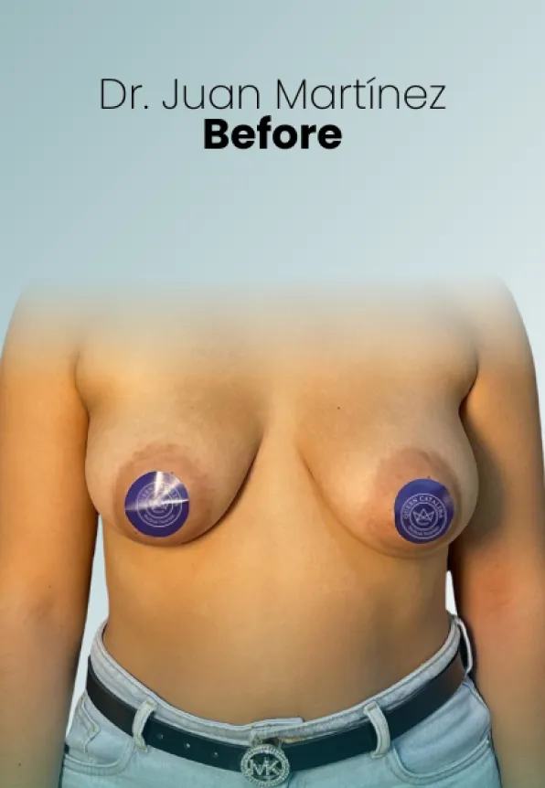 Surgeon Biography Juan Martinez Procedure Img44 Queen Catalina