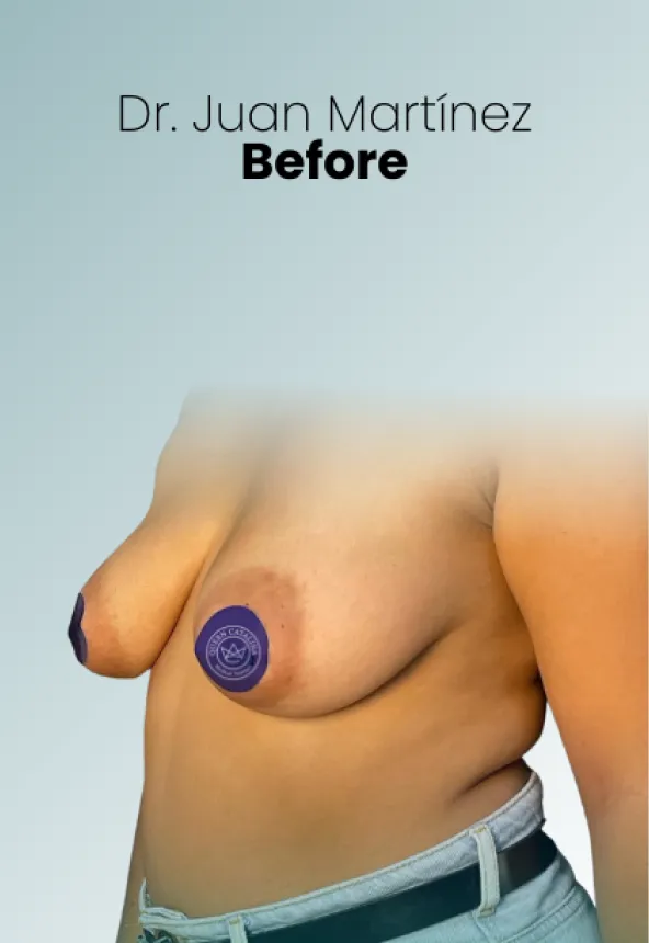 Surgeon Biography Juan Martinez Procedure Img46 Queen Catalina