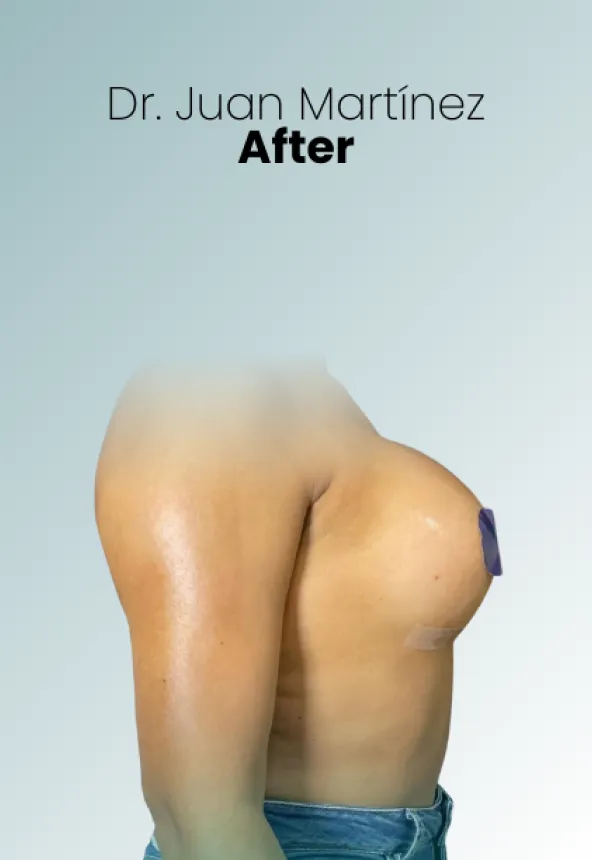 Surgeon Biography Juan Martinez Procedure Img47 Queen Catalina