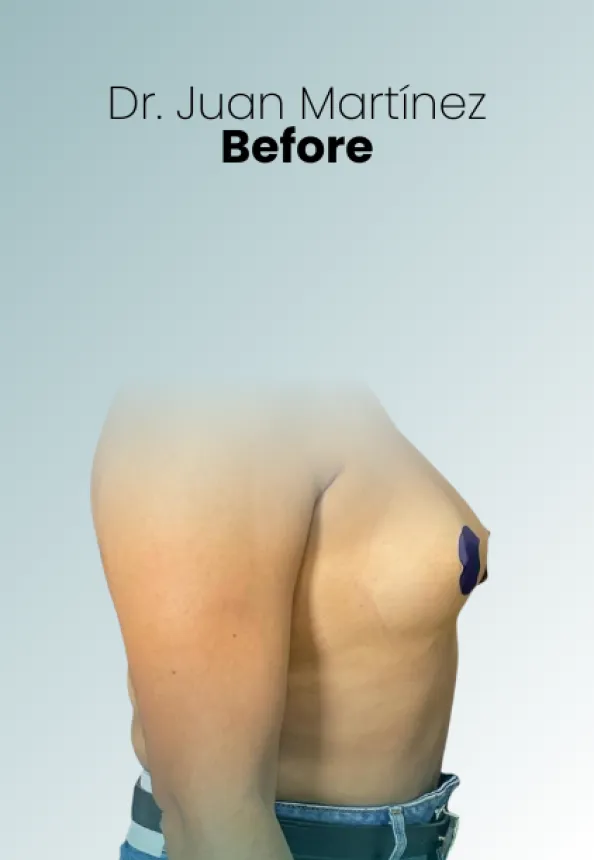 Surgeon Biography Juan Martinez Procedure Img48 Queen Catalina