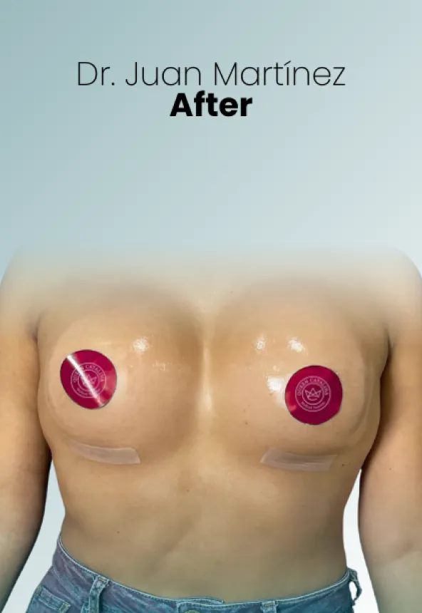 Surgeon Biography Juan Martinez Procedure Img49 Queen Catalina