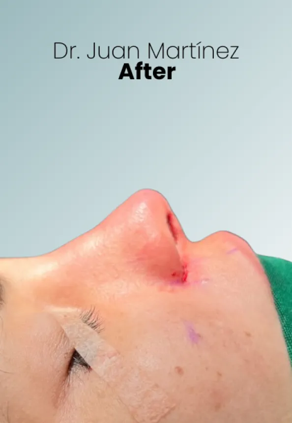 Surgeon Biography Juan Martinez Procedure Img5 Queen Catalina