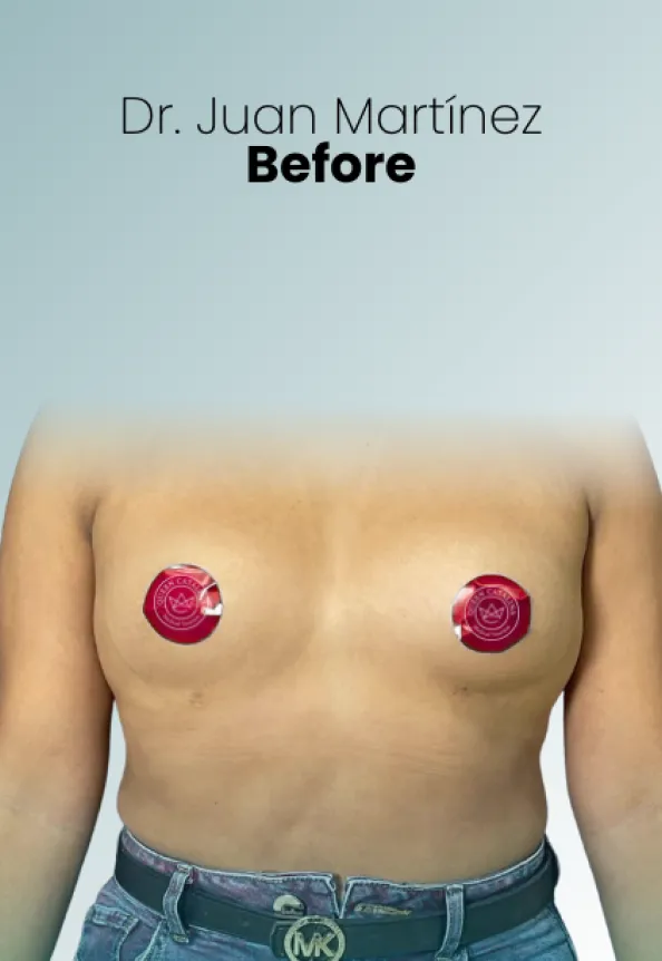 Surgeon Biography Juan Martinez Procedure Img51 Queen Catalina