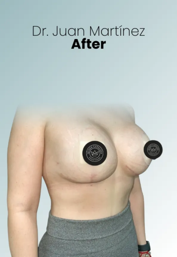 Surgeon Biography Juan Martinez Procedure Img53 Queen Catalina