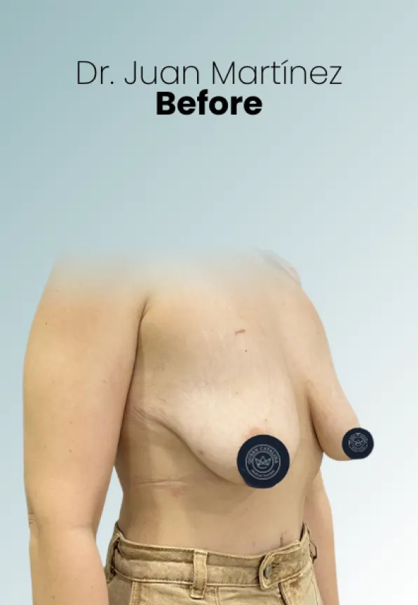 Surgeon Biography Juan Martinez Procedure Img54 Queen Catalina