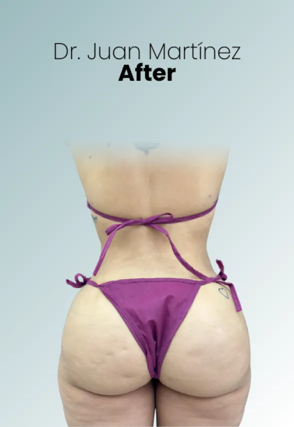 Surgeon Biography Juan Martinez Procedure Img55 Queen Catalina