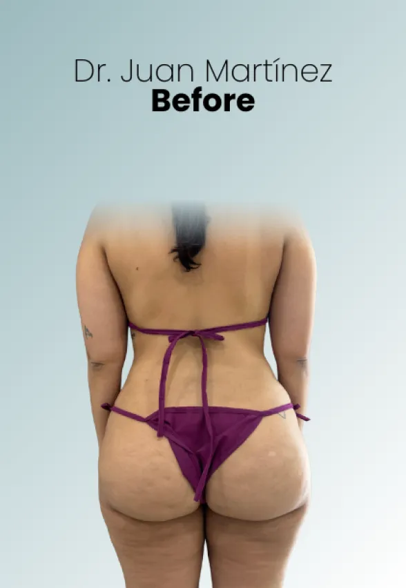 Surgeon Biography Juan Martinez Procedure Img56 Queen Catalina