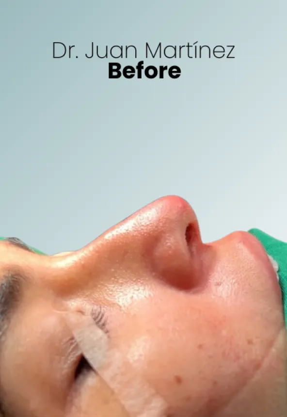 Surgeon Biography Juan Martinez Procedure Img6 Queen Catalina